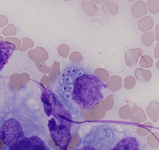 Possible Histoplasma x 1000